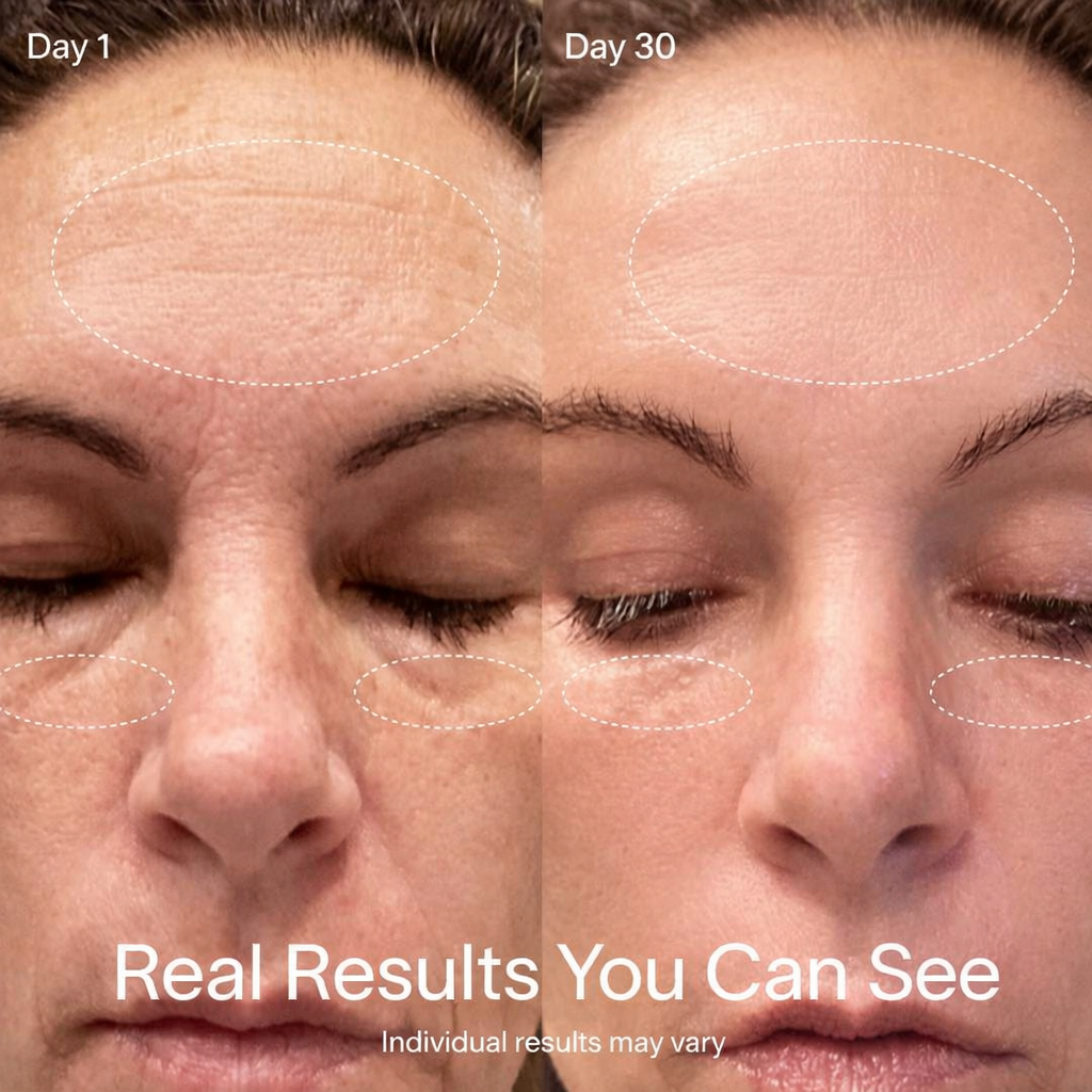 RevitaRay™ Skin Renewal System